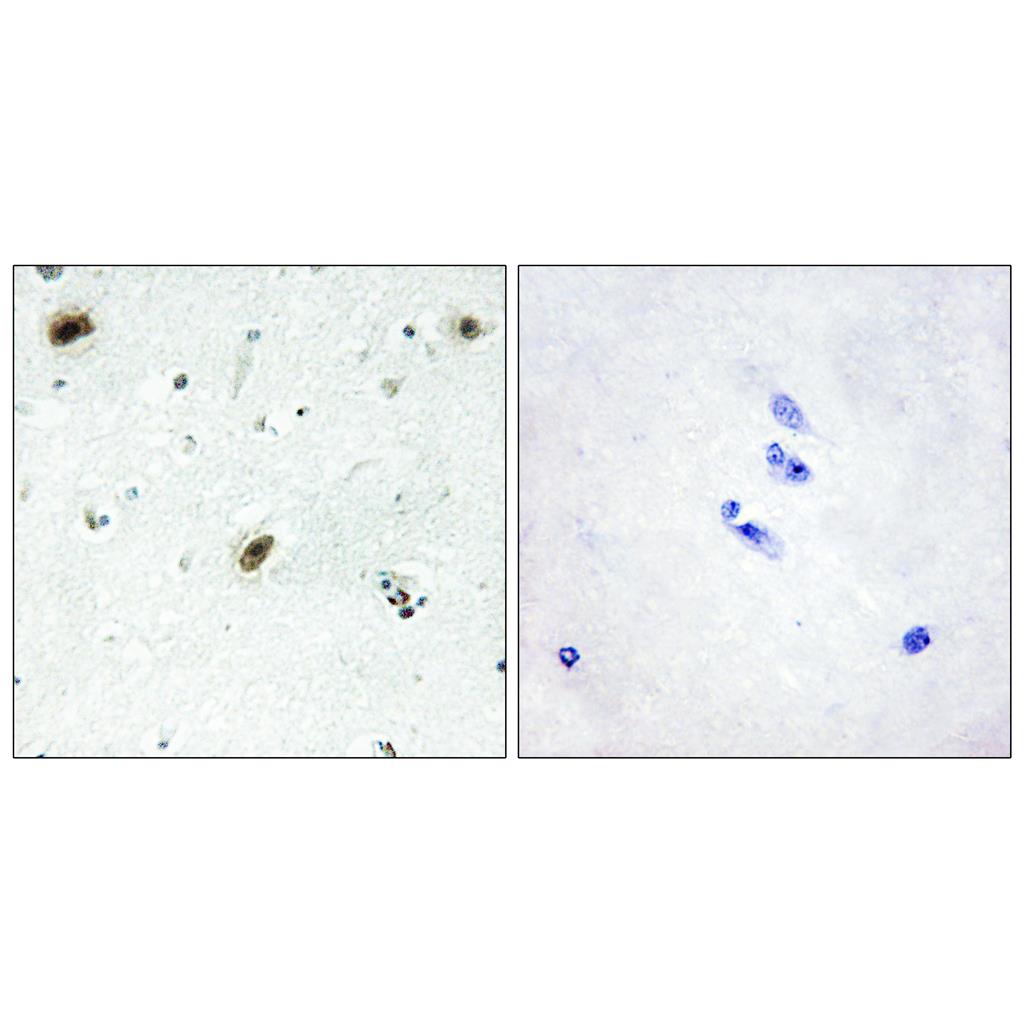c-Abl Rabbit Polyclonal Antibody | 兔多抗 | EnkiLife恩玑生命