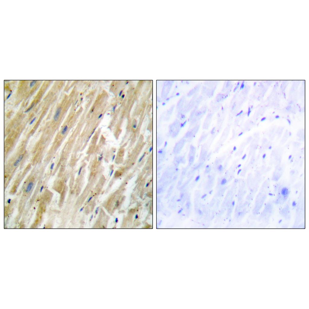 Calregulin Rabbit Polyclonal Antibody | 兔多抗 | EnkiLife恩玑生命