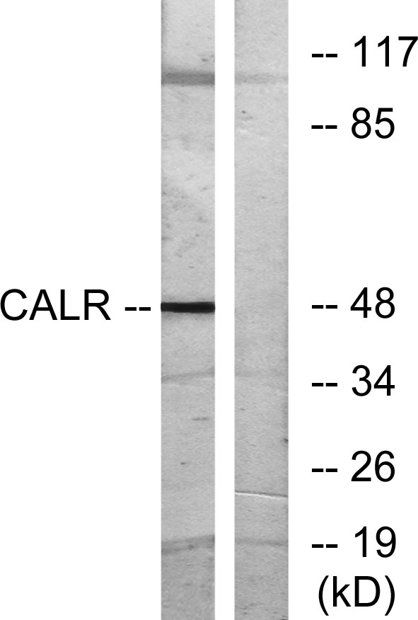 Calregulin Rabbit Polyclonal Antibody | 兔多抗 | EnkiLife恩玑生命