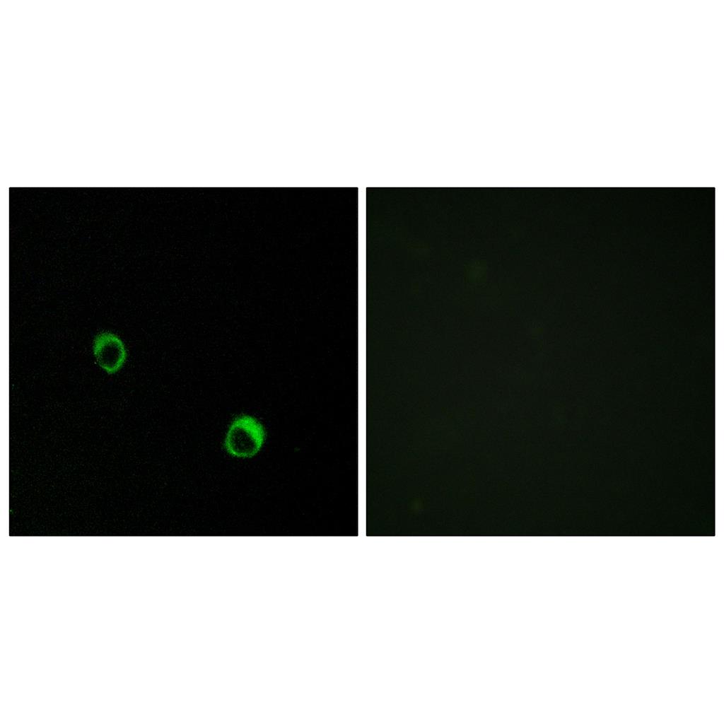 CARD 14 Rabbit Polyclonal Antibody | 兔多抗 | EnkiLife恩玑生命