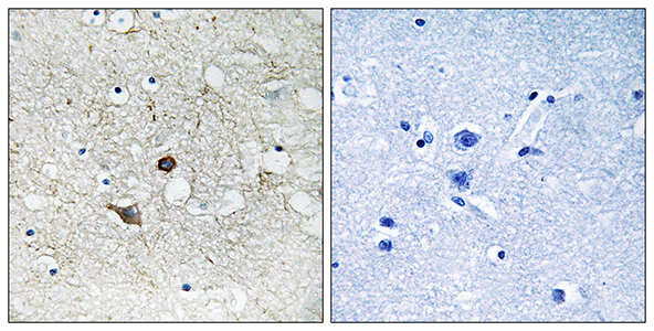 Caspase-2 Rabbit Polyclonal Antibody | 兔多抗 | EnkiLife恩玑生命