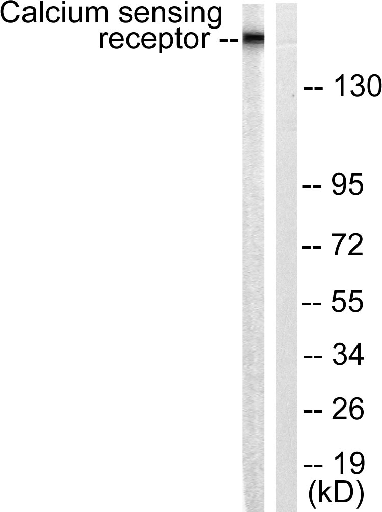 CaSR Rabbit Polyclonal Antibody | 兔多抗 | EnkiLife恩玑生命