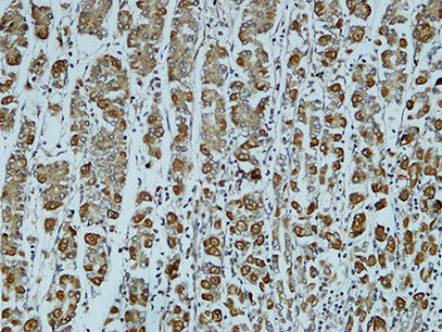 Catenin-α1 Rabbit Polyclonal Antibody | 兔多抗 | EnkiLife恩玑生命