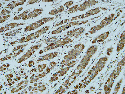 Catenin-α1 Rabbit Polyclonal Antibody | 兔多抗 | EnkiLife恩玑生命