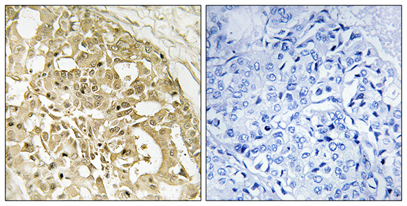 Catenin-β Rabbit Polyclonal Antibody | 兔多抗 | EnkiLife恩玑生命