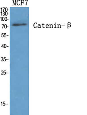 Catenin-β Rabbit Polyclonal Antibody | 兔多抗 | EnkiLife恩玑生命