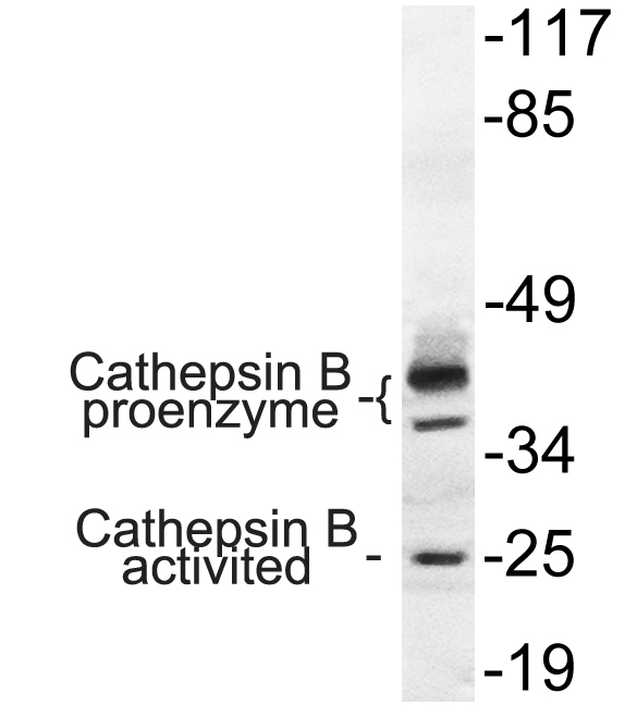 Cathepsin B Rabbit Polyclonal Antibody | 兔多抗 | EnkiLife恩玑生命