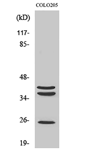 Cathepsin B Rabbit Polyclonal Antibody | 兔多抗 | EnkiLife恩玑生命