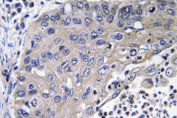 Cathepsin?D Rabbit Polyclonal Antibody | 兔多抗 | EnkiLife恩玑生命