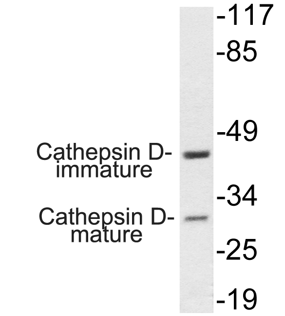 Cathepsin?D Rabbit Polyclonal Antibody | 兔多抗 | EnkiLife恩玑生命
