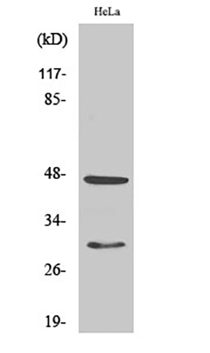 Cathepsin?D Rabbit Polyclonal Antibody | 兔多抗 | EnkiLife恩玑生命