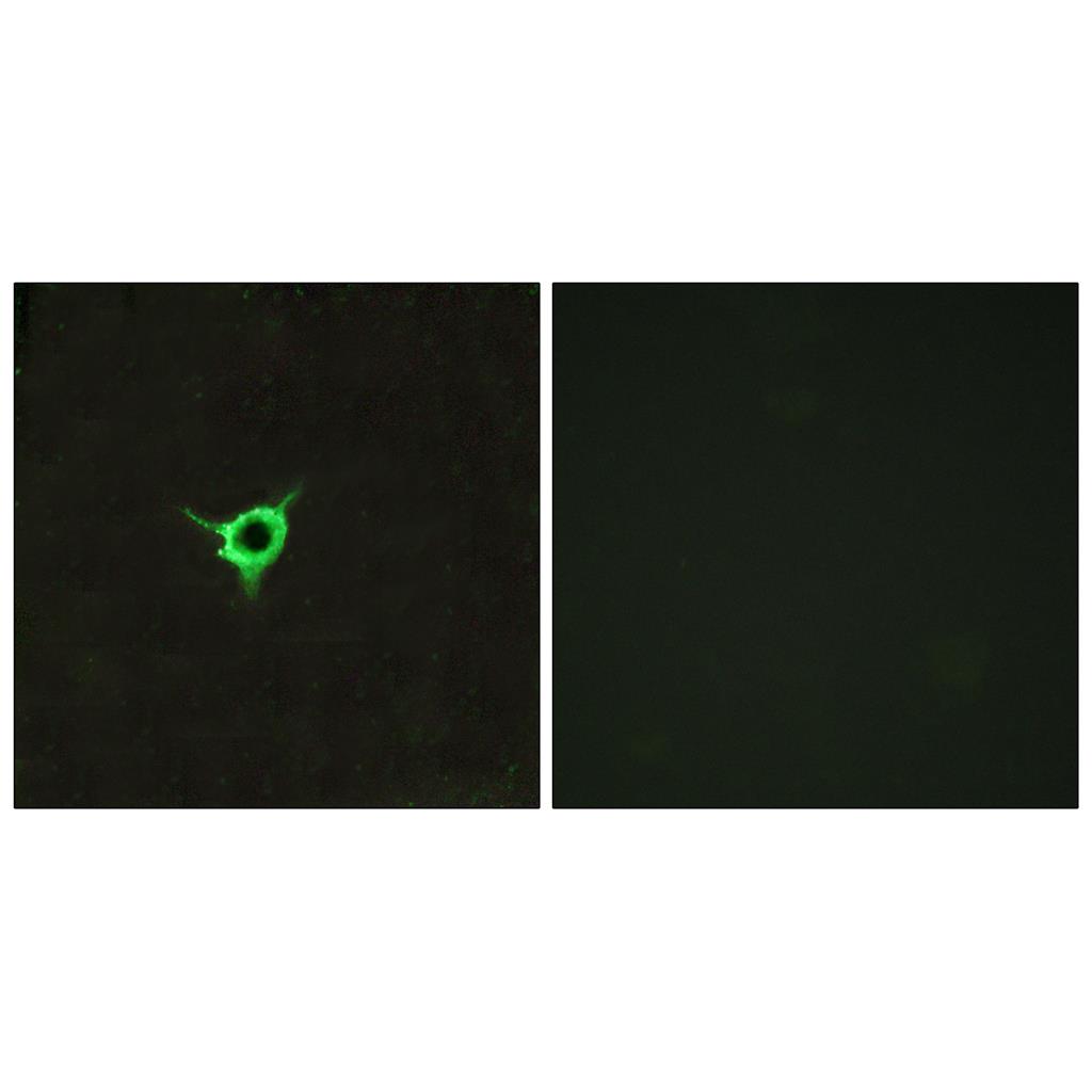 CB1 Rabbit Polyclonal Antibody | 兔多抗 | EnkiLife恩玑生命