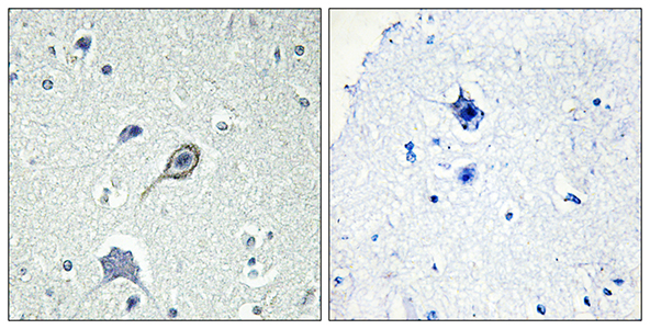 CB1 Rabbit Polyclonal Antibody | 兔多抗 | EnkiLife恩玑生命