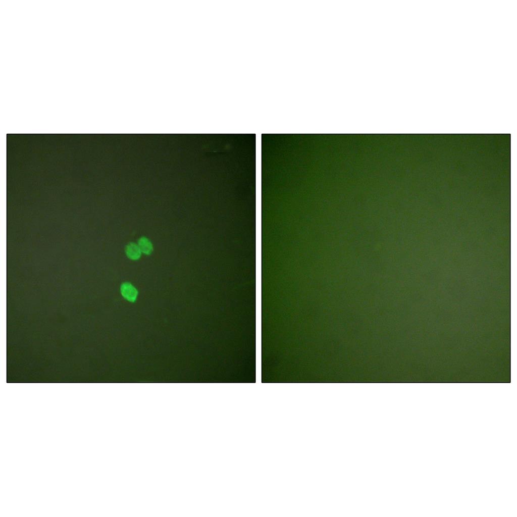 CBP 35 Rabbit Polyclonal Antibody | 兔多抗 | EnkiLife恩玑生命