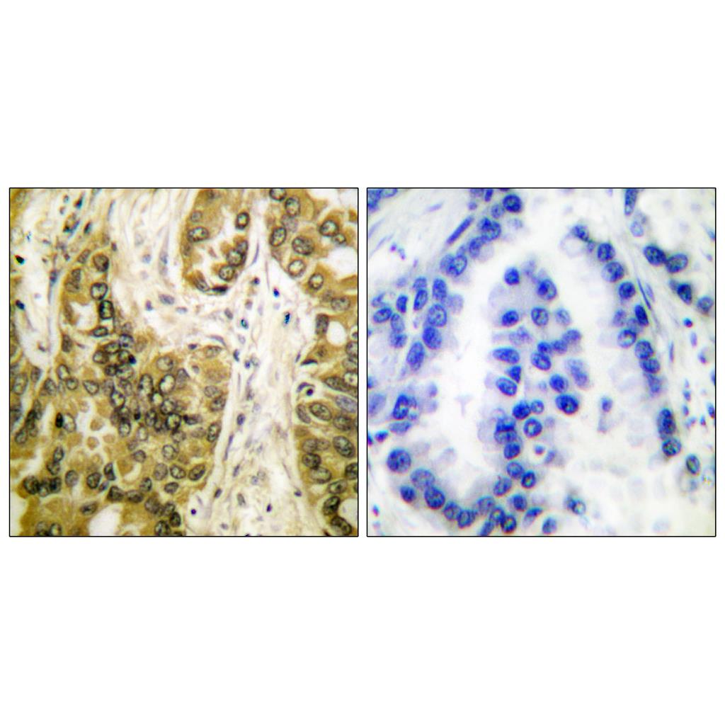 CBP 35 Rabbit Polyclonal Antibody | 兔多抗 | EnkiLife恩玑生命