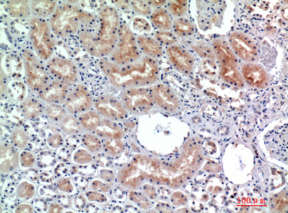 CD26 Rabbit Polyclonal Antibody | 兔多抗 | EnkiLife恩玑生命