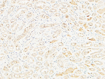 CD26 Rabbit Polyclonal Antibody | 兔多抗 | EnkiLife恩玑生命