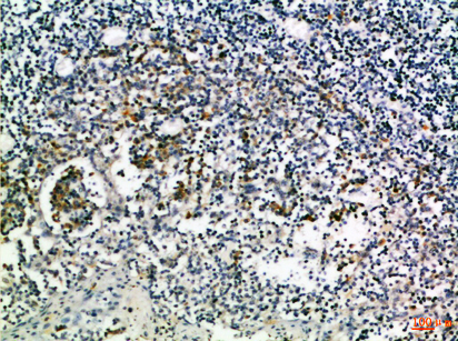 CD274 Rabbit Polyclonal Antibody | 兔多抗 | EnkiLife恩玑生命