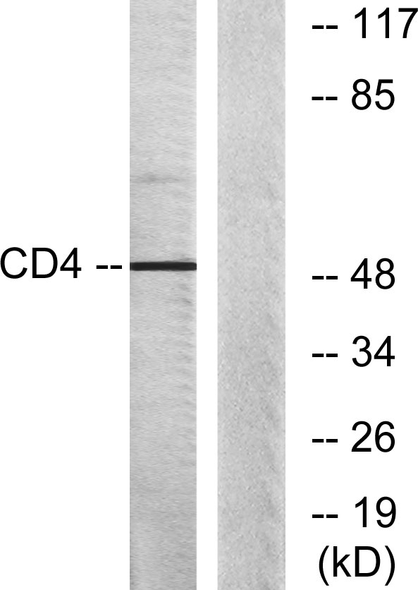 CD4 Rabbit Polyclonal Antibody | 兔多抗 | EnkiLife恩玑生命
