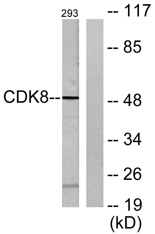 Cdk8 Rabbit Polyclonal Antibody | 兔多抗 | EnkiLife恩玑生命