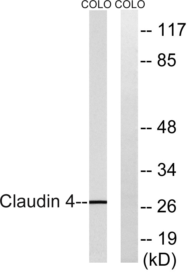 Claudin-4 Rabbit Polyclonal Antibody | 兔多抗 | EnkiLife恩玑生命