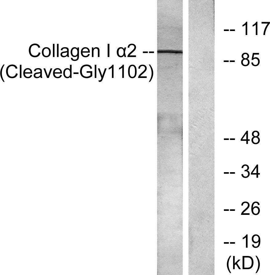 Cleaved-COL1A2 (G1102) Rabbit Polyclonal Antibody | 兔多抗 | EnkiLife恩玑生命