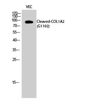 Cleaved-COL1A2 (G1102) Rabbit Polyclonal Antibody | 兔多抗 | EnkiLife恩玑生命