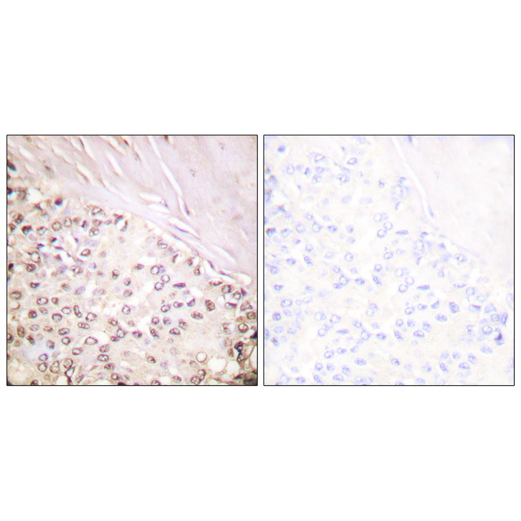 FANCD2 Rabbit Polyclonal Antibody | 兔多抗 | EnkiLife恩玑生命