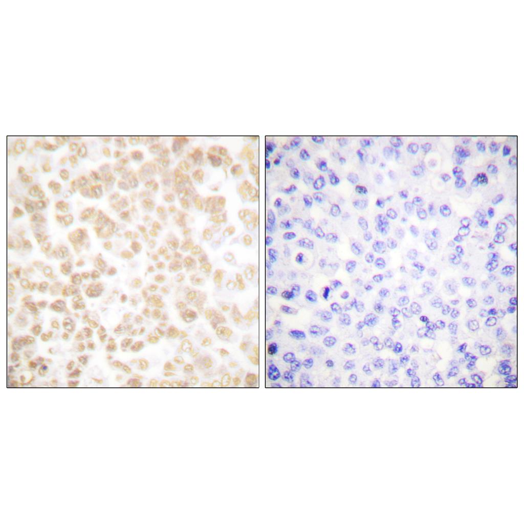 FOSL2 Rabbit Polyclonal Antibody | 兔多抗 | EnkiLife恩玑生命