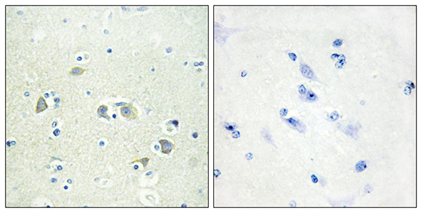 Gas6 Rabbit Polyclonal Antibody | 兔多抗 | EnkiLife恩玑生命