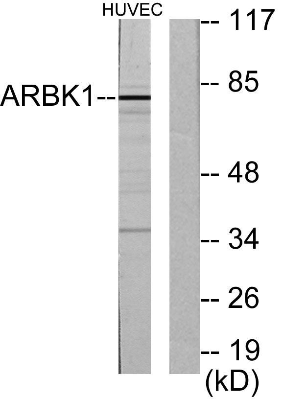 GRK 2 Rabbit Polyclonal Antibody | 兔多抗 | EnkiLife恩玑生命