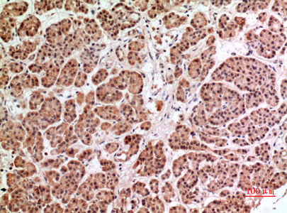 HPA1 Rabbit Polyclonal Antibody | 兔多抗 | EnkiLife恩玑生命