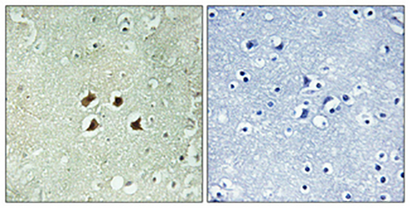 Huntingtin Rabbit Polyclonal Antibody | 兔多抗 | EnkiLife恩玑生命