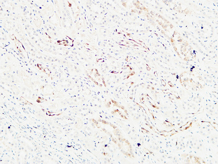 K-Ras Rabbit Polyclonal Antibody | 兔多抗 | EnkiLife恩玑生命
