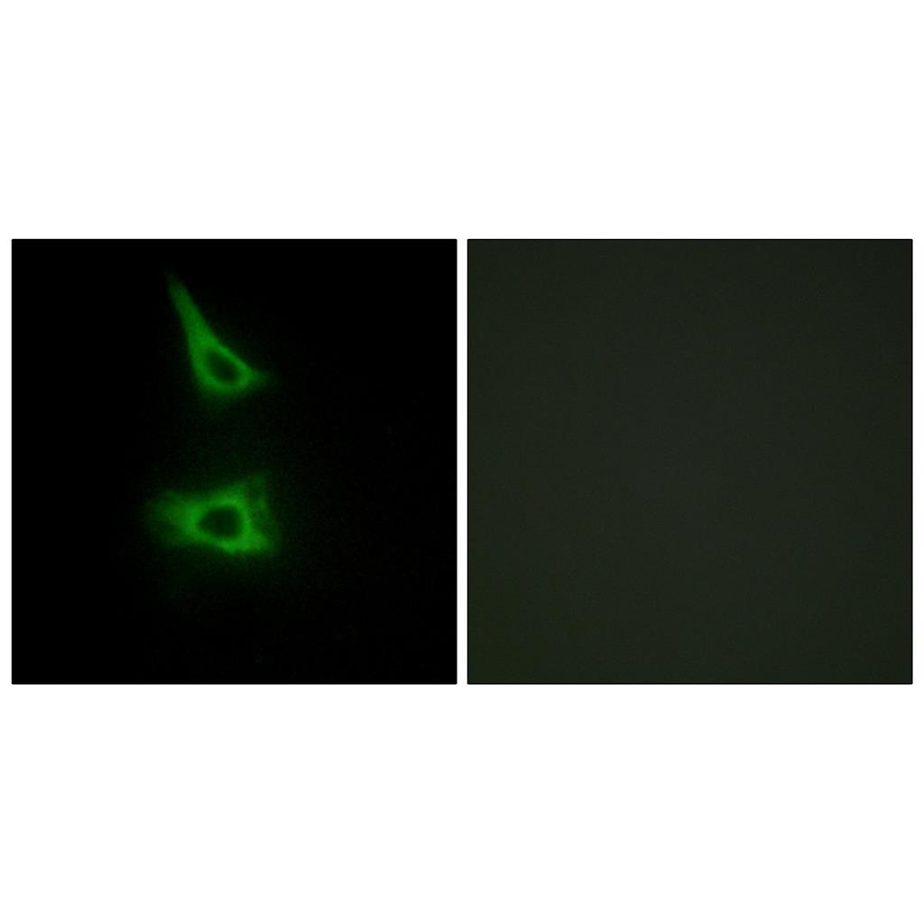 LI-cadherin Rabbit Polyclonal Antibody | 兔多抗 | EnkiLife恩玑生命