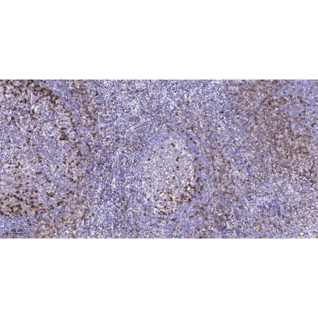 LRBA Rabbit Polyclonal Antibody | 兔多抗 | EnkiLife恩玑生命
