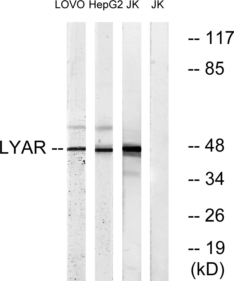 LYAR Rabbit Polyclonal Antibody | 兔多抗 | EnkiLife恩玑生命