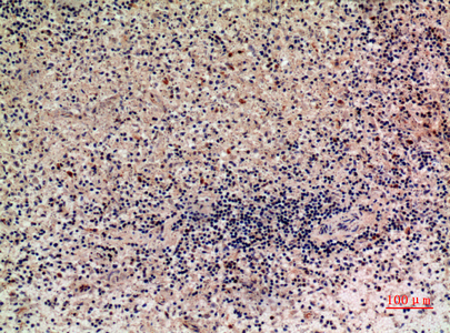 Lymphotactin Rabbit Polyclonal Antibody | 兔多抗 | EnkiLife恩玑生命