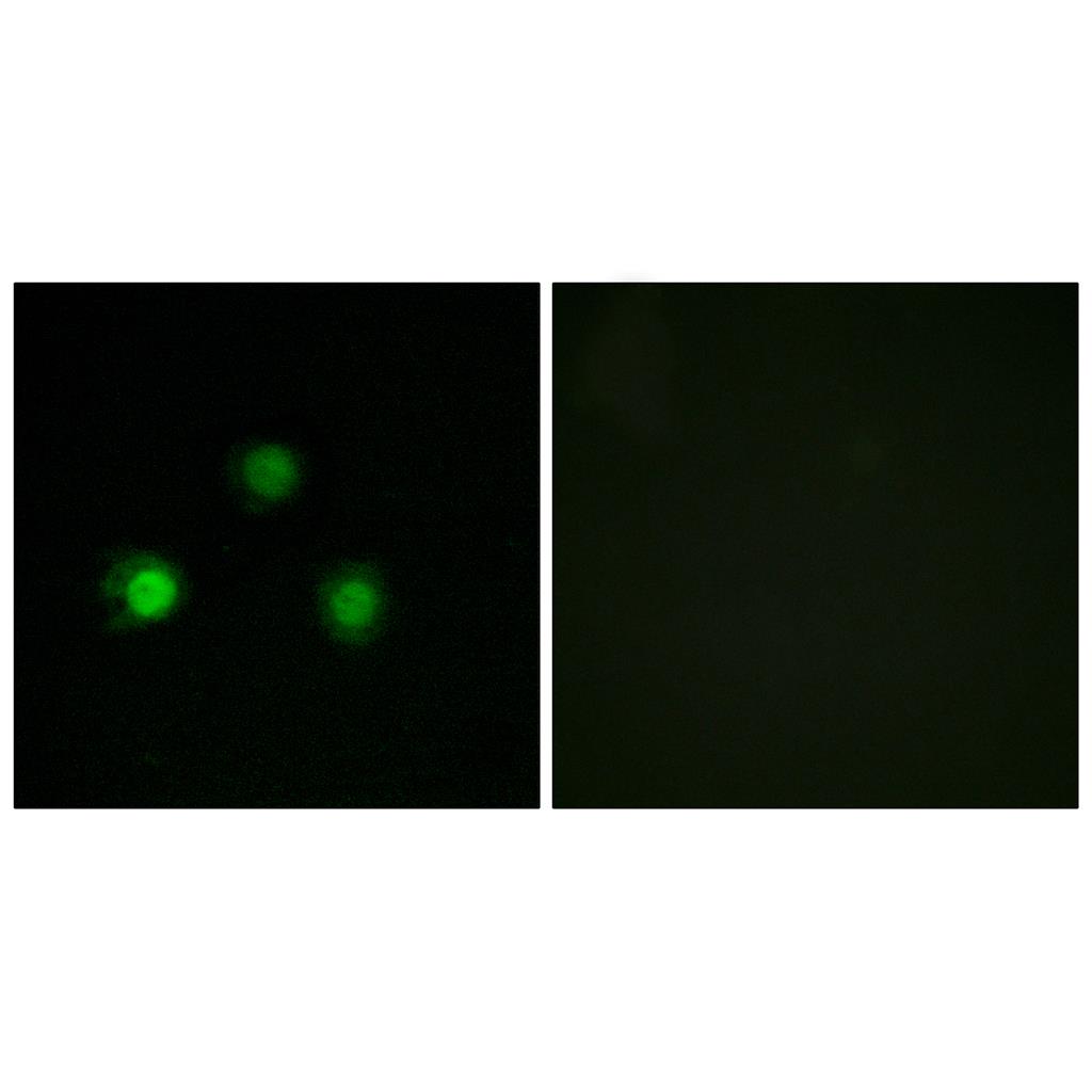 MSH2 Rabbit Polyclonal Antibody | 兔多抗 | EnkiLife恩玑生命