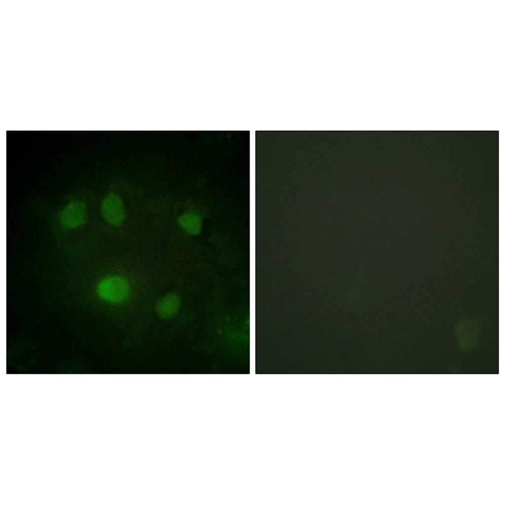 p68 RNA Helicase Rabbit Polyclonal Antibody | 兔多抗 | EnkiLife恩玑生命