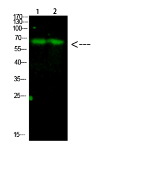 Parafibromin Rabbit Polyclonal Antibody | 兔多抗 | EnkiLife恩玑生命