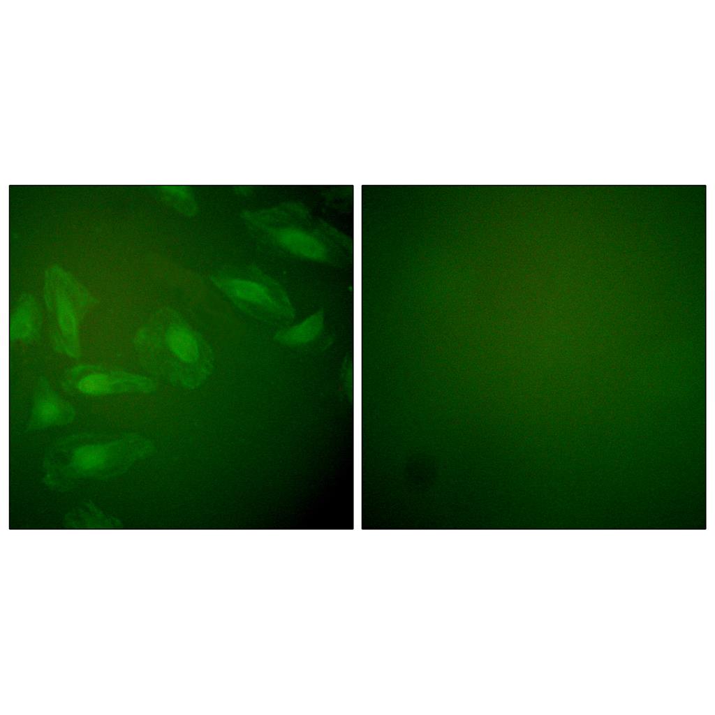PARK7 Rabbit Polyclonal Antibody | 兔多抗 | EnkiLife恩玑生命