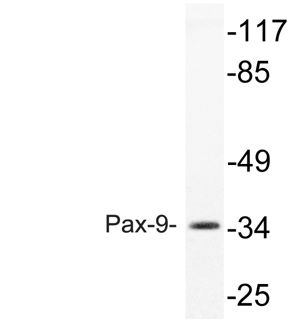Pax-9 Rabbit Polyclonal Antibody | 兔多抗 | EnkiLife恩玑生命