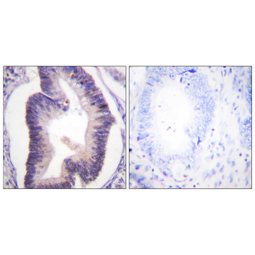PFK-2 car Rabbit Polyclonal Antibody | 兔多抗 | EnkiLife恩玑生命