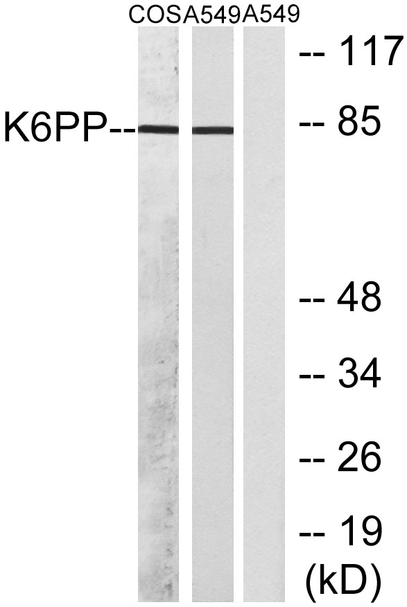PFK-C Rabbit Polyclonal Antibody | 兔多抗 | EnkiLife恩玑生命