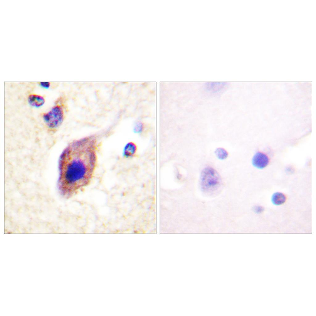 PLC γ2 Rabbit Polyclonal Antibody | 兔多抗 | EnkiLife恩玑生命