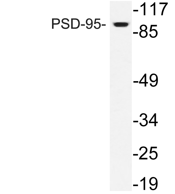 PSD-95 Rabbit Polyclonal Antibody | 兔多抗 | EnkiLife恩玑生命