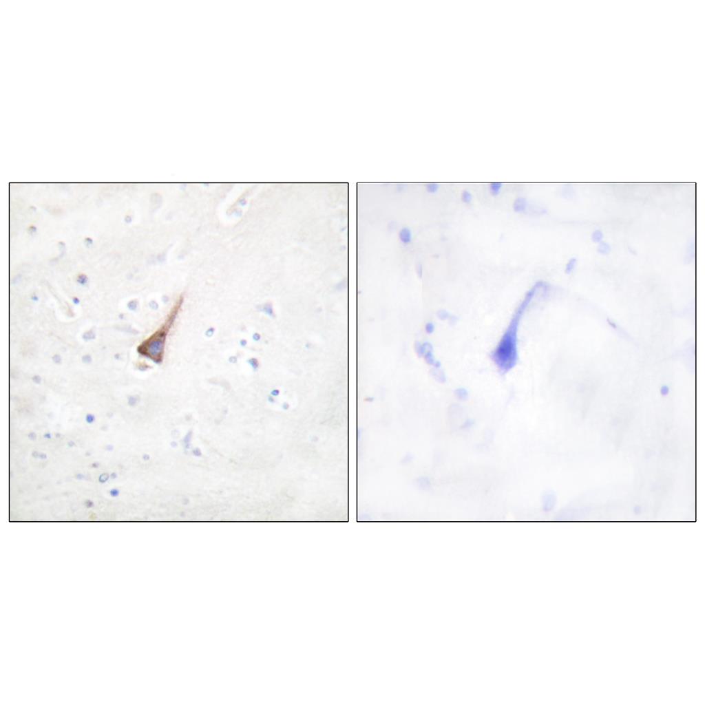 PTP1B Rabbit Polyclonal Antibody | 兔多抗 | EnkiLife恩玑生命