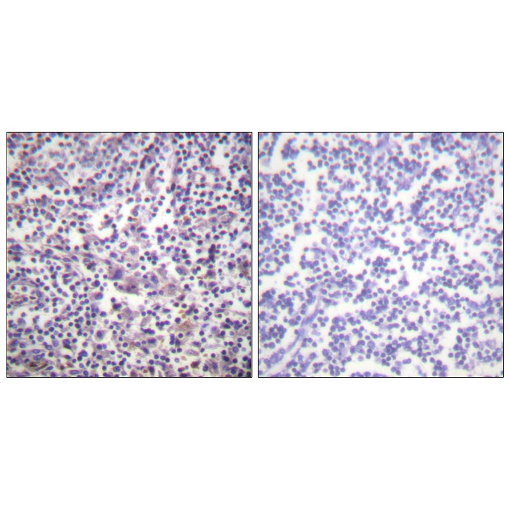 Raf-B Rabbit Polyclonal Antibody | 兔多抗 | EnkiLife恩玑生命