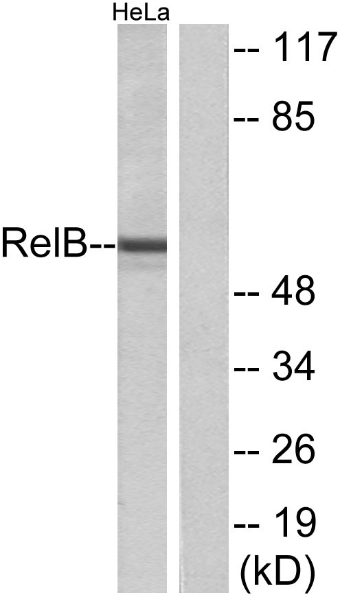 RelB Rabbit Polyclonal Antibody | 兔多抗 | EnkiLife恩玑生命